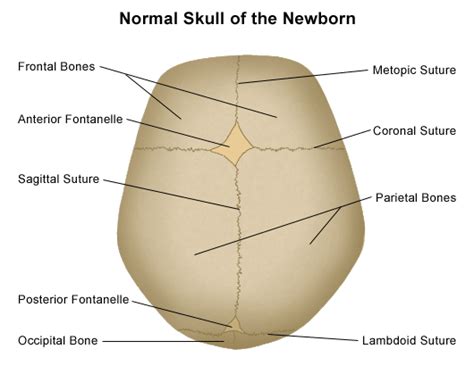 Craniosynostosis | Johns Hopkins Medicine