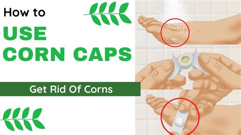 How to Use Corn Caps - Get Rid of Corns (Step by Step Process) - YouTube