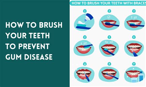 How to Brush Your Teeth to Prevent Gum Disease