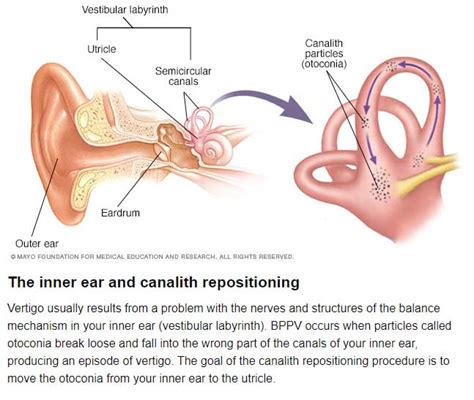 My Antacid Was Causing BPPV Vertigo – My BPPV Vertigo Story