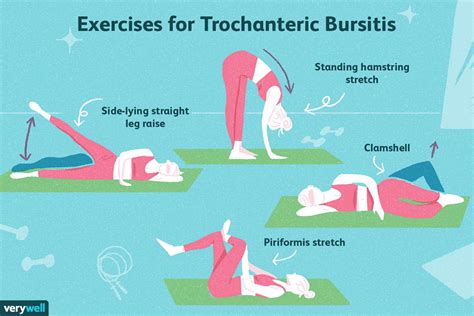 Trochanteric Bursitis Physical Therapy: What to Expect