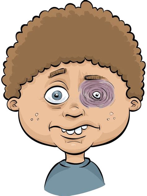 Boy with Black Eye stock illustration. Illustration of child - 41194928