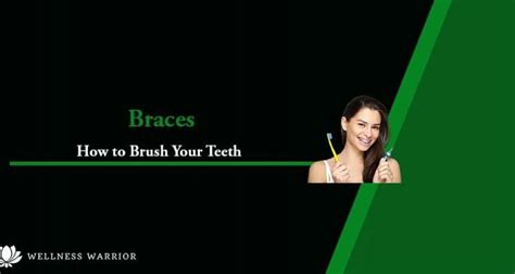 How to Brush Your Teeth with Braces