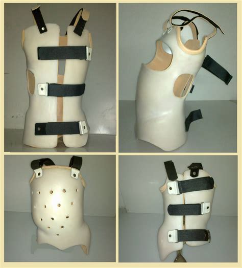 Scoliosis Brace at Rs 8500/unit | तोरकोलुंबोसकराल ओर्थोसिस ब्रेस ...