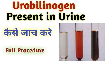 urobilinogen test procedure | urobilinogen test | urobilinogen test ...