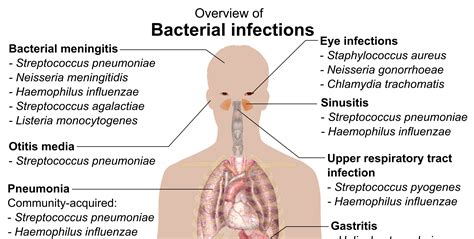 Overview of the Bacterial Infections Chart - NCLEX Quiz