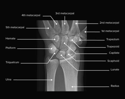 Wrist Joint: Anatomy | Concise Medical Knowledge