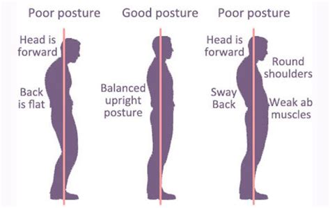 Abnormal Posture : Type, Cause, Symptom's, Exercise