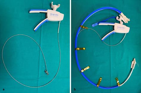 Common and Uncommon Problems During Endoscopic Suturing With Apollo ...