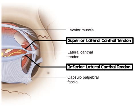 Components of Lateral Canthal Tendon - REBEL EM - Emergency Medicine Blog