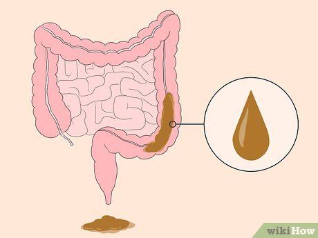 How to Know If You Have Worms: Intestinal Parasite Symptoms