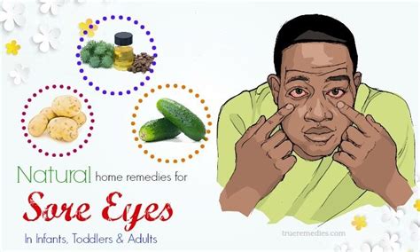 19 Home Remedies For Sore Eyes In Infants, Toddlers & Adults