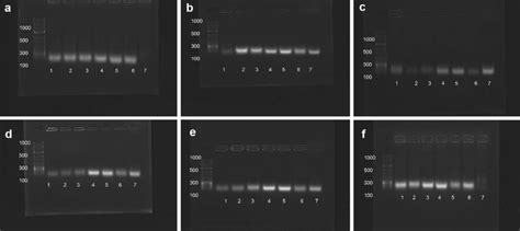 Agarose gel electrophoresis of amplified genes. A 1000 bp DNA ladder ...