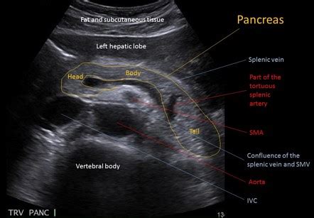 Abnormal Pancreas Ultrasound