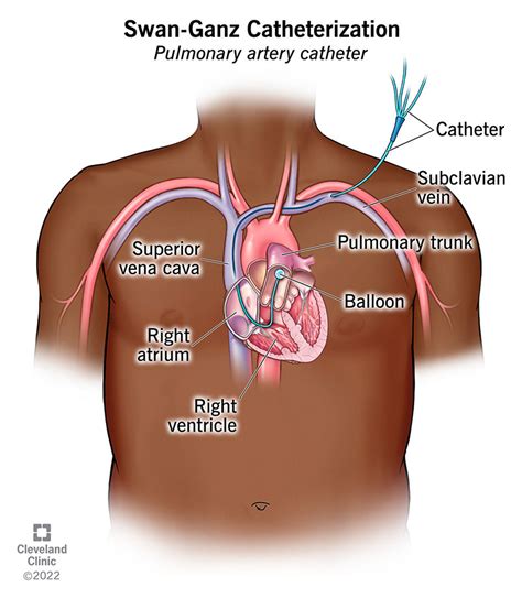 Subclavian Vein Heart