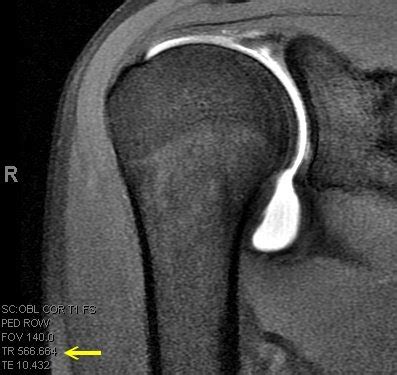 Services | Arthrograms