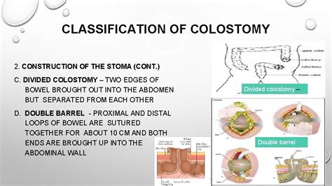 Outline ENDOSCOPY INDICATIONS CONTRAINDICATIONS COMPLICATIONS NURSING ...