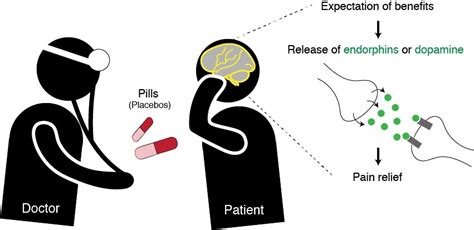 More Than Just a Sugar Pill: Why the placebo effect is real - Science ...