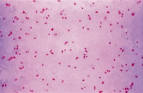 Gram Negative Cocci In Clusters