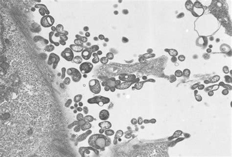 Mycoplasma Cell Culture Contamination Symptoms