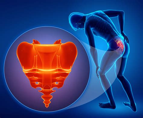 Sacrum and Coccyx Pain Management | Pain Solutions Medical