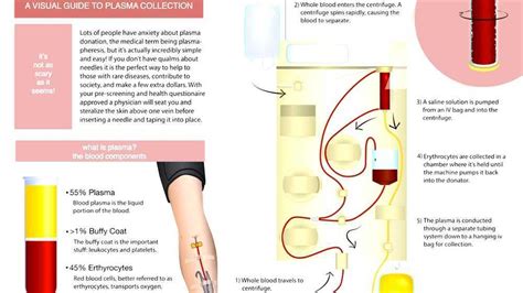 Plasmapheresis