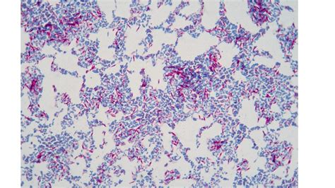 ACID-FAST STAIN – Laboratory Exercises in Microbiology