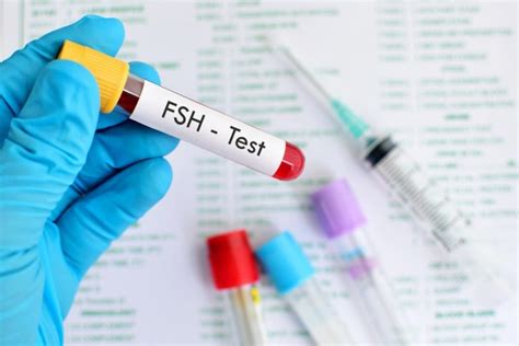 A Comprehensive Overview of the Follicle-Stimulating Hormone (FSH) Test ...