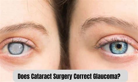 Does Cataract Surgery Correct Glaucoma?