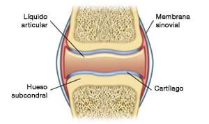 Osteoartritis: ¿Conoce usted cómo es una articulación normal?