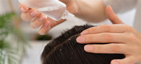 Dandruff treatment: Simply treat dandruff yourself at home – Laifen - US