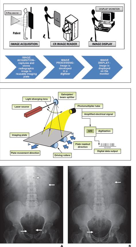 Computed radiography image artifacts revisited. | Semantic Scholar