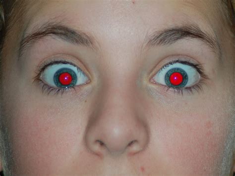 What Causes Red Eyes In Photographs