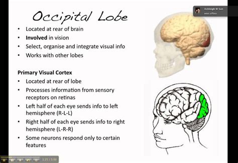 temporal lobe function - Google Search in 2020 | Occipital lobe ...