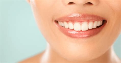 How to Achieve a Winning Smile - CK DENTAL