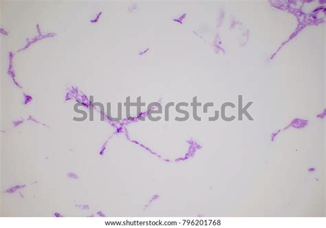 Bacteria On Slide Under Microscope Constitute Stock Photo 796201768 ...