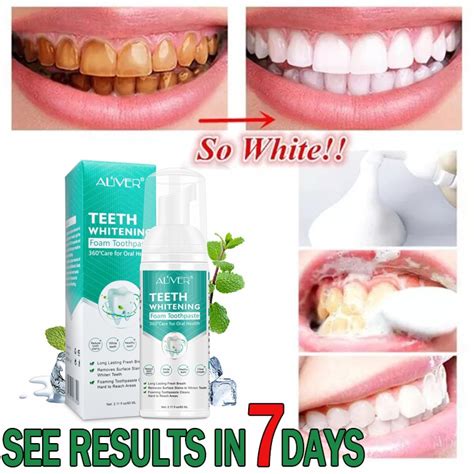 ALIVER Teeth Whitening Mousse Toothpaste Cleansing teeth Mousse Remove ...