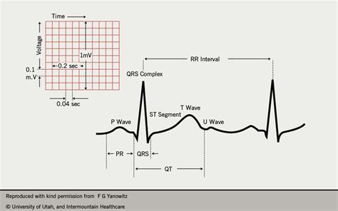 Normal Qrs Time