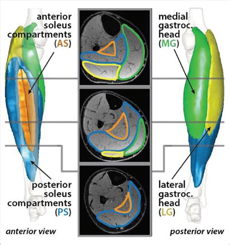 | Triceps surae muscles were segmented in axial MR images. The muscle ...