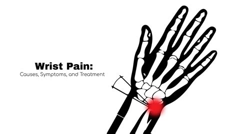 Wrist Pain: Causes, Symptoms, and Treatment ~ Stat! Cardiologist