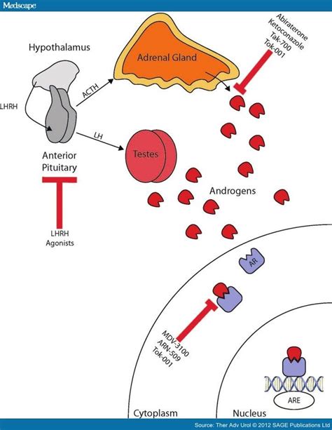 IrminadyBuzzeo: Prostate cancer treatment Enzalutamide