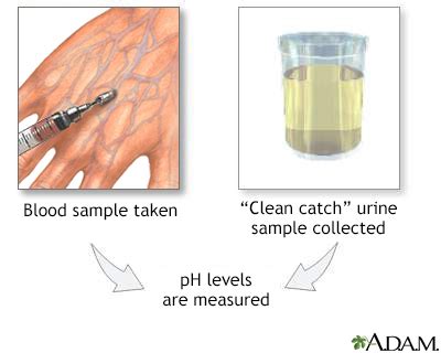 Urine pH test Information | Mount Sinai - New York