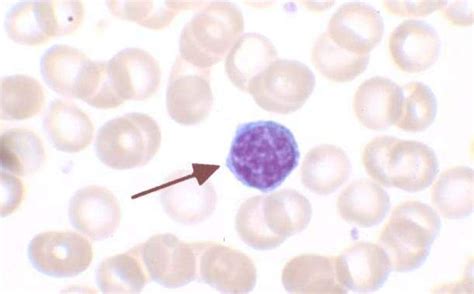 What is the Difference Between Monocytes and Lymphocytes - Pediaa.Com