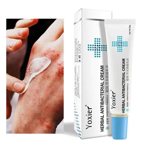 Yoxier Herbal Antibacterial Cream Psoriasis Cream Anti-itch Relief ...