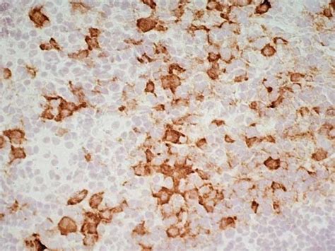 Anti Mouse IgG1 Antibody | Bio-Rad