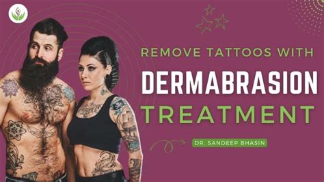 Dermabrasion Treatment for Tattoo Removal | Care Well Medical Centre