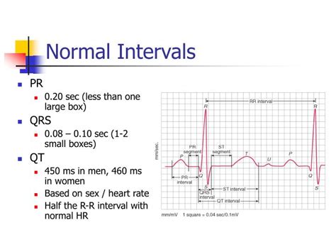 Ecg Interval Normal Ranges | Hot Sex Picture