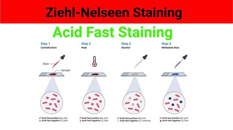 Ziehl Neelsen stain | Acid Fast Staining Test | Acid fast staining test ...