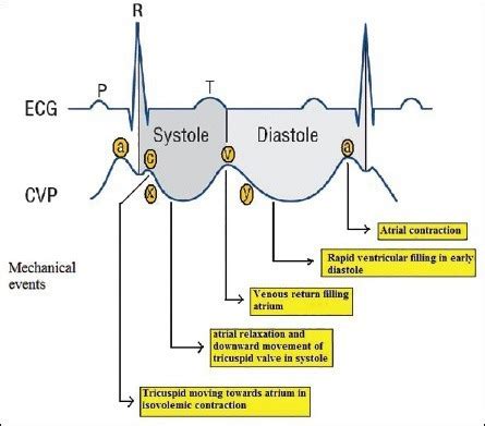 CVP waveforms with corresponding cardiac events and ECG