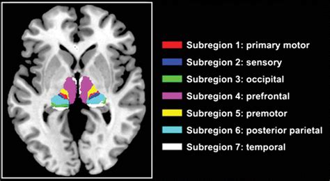 Multimodal Quantitative MR Imaging of the Thalamus in Multiple ...